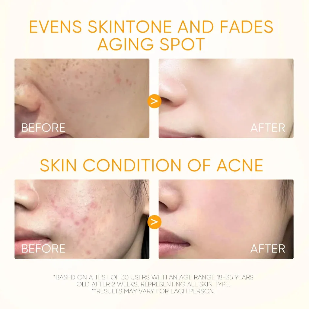 10% Vitamin C Brightening Glow Serum 20ml