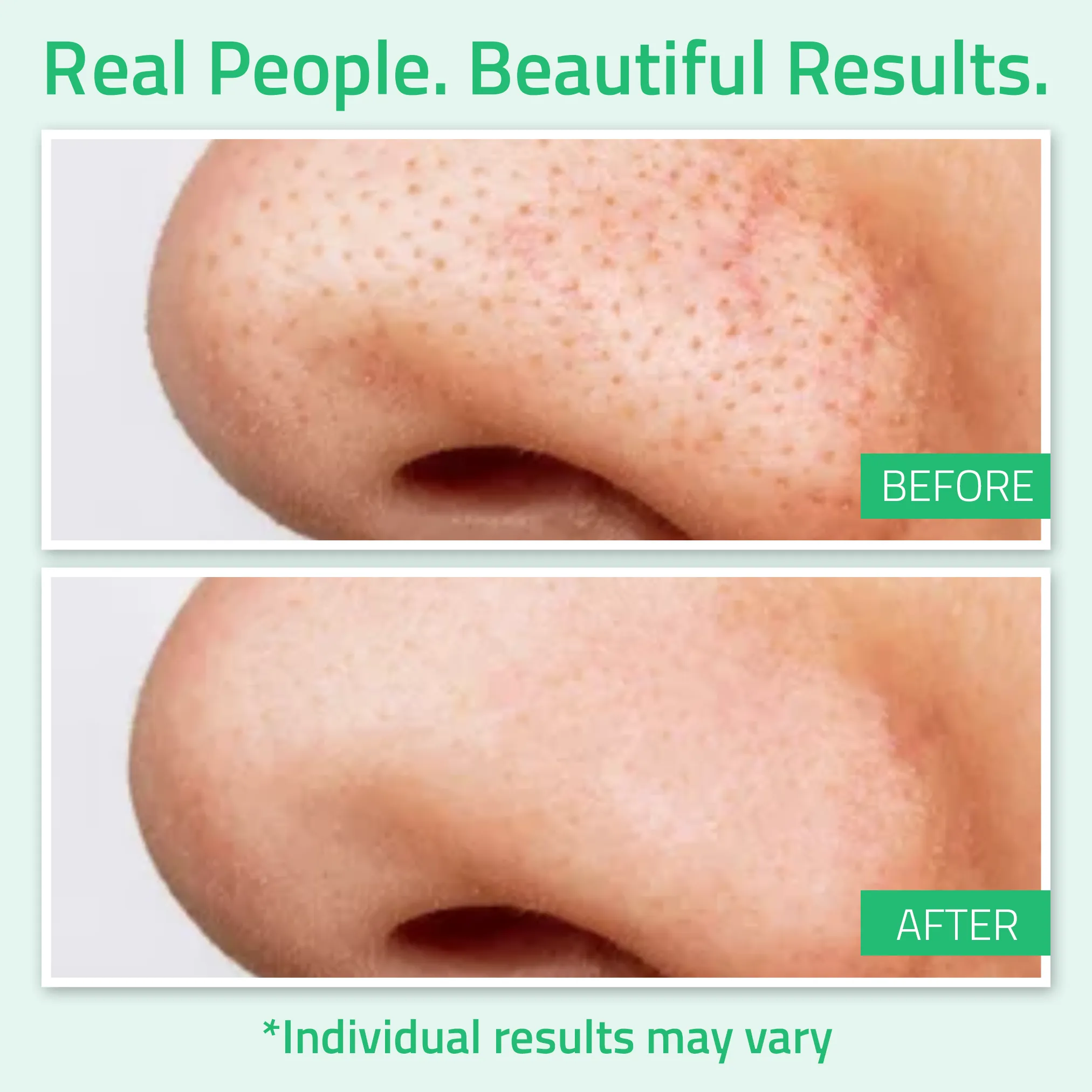 Glycolic Acid Face Toner